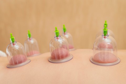 Cupping Therapy: Know About it